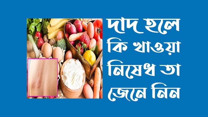 দাদ হলে কি খাওয়া নিষেধ