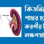কিডনিতে পাথর হলে করণীয় কি